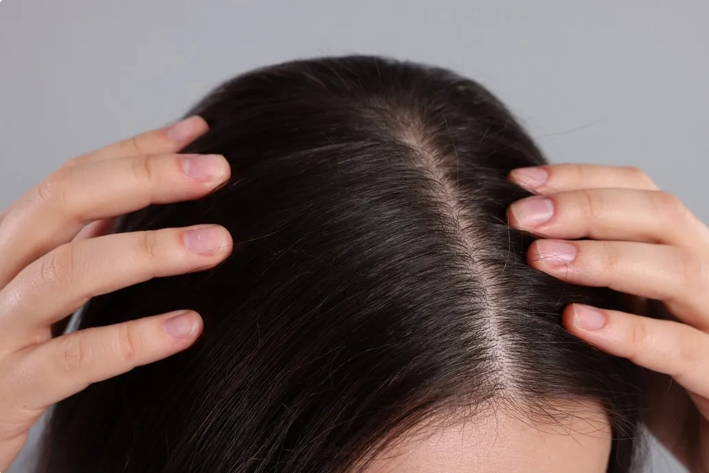
                                                                                            Why Does Hair Get Oily and How to Prevent It? Expert Advice
                                            
